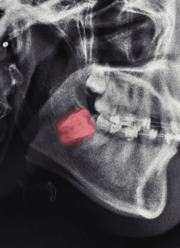 Treatment - Hampstead Dental Studio