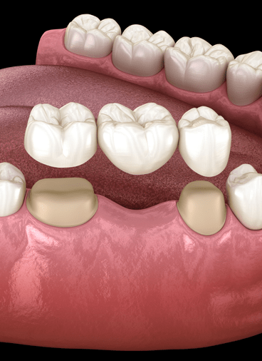 Treatment - Hampstead Dental Studio