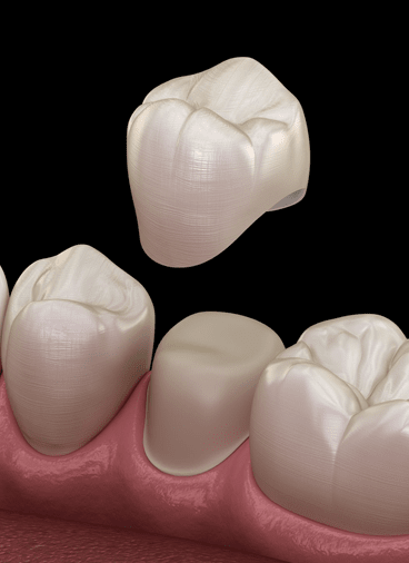 Treatment - Hampstead Dental Studio