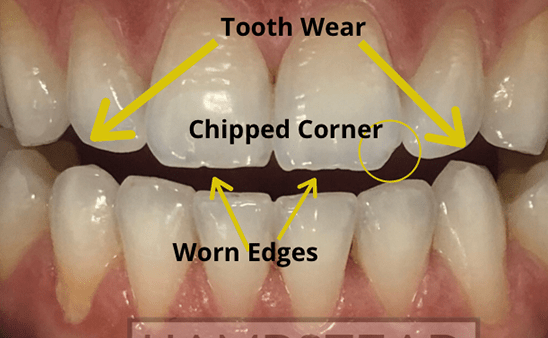 Before - Hampstead Dental Studio