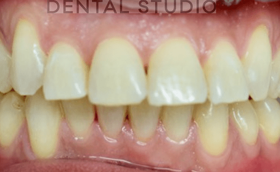 After - Hampstead Dental Studio