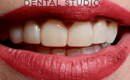 After - Hampstead Dental Studio