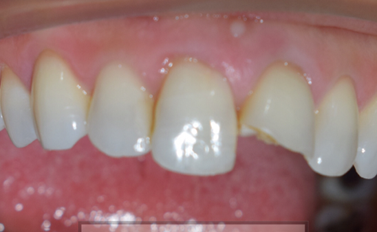 Before - Hampstead Dental Studio