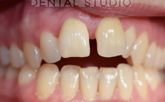After - Hampstead Dental Studio
