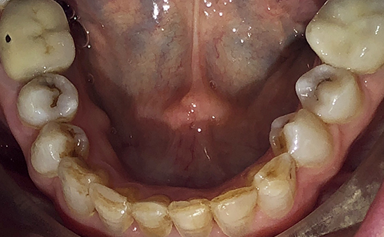 After - Hampstead Dental Studio