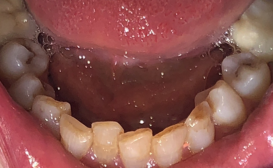 Before - Hampstead Dental Studio