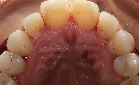 Before - Hampstead Dental Studio