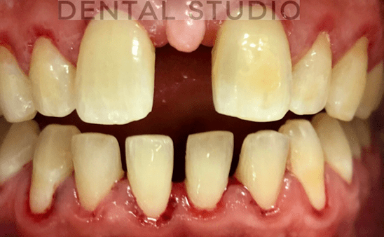 After - Hampstead Dental Studio