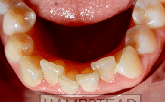 Before - Hampstead Dental Studio