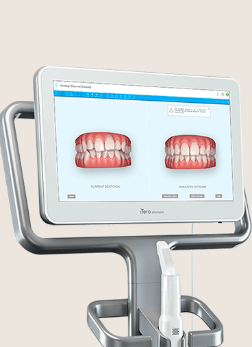 iTero Intraoral 3D Scanner